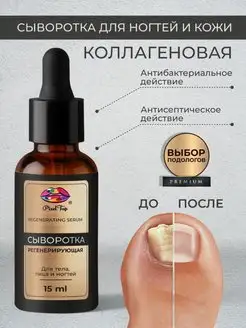 Скидка на Средство от грибка ногтей стоп онихолизис 15 мл